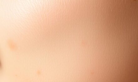 Przebarwienia po depilacji — kiedy zobaczysz efekty i jak stosować bez podrażnień